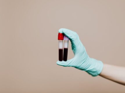Leaky Gut Syndrom Blutwerte